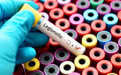 Legionella: What is it? Way of Contaminations and Risk on Human Health